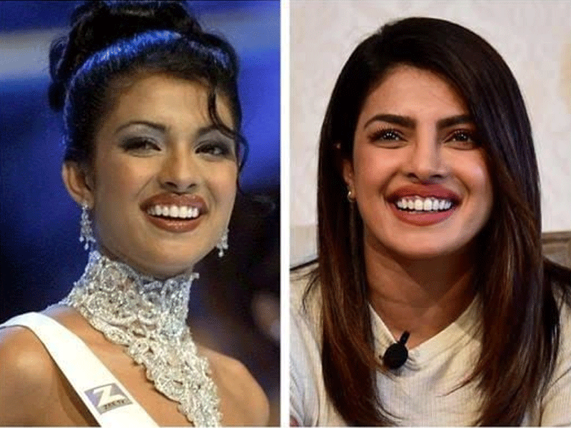 I went into depression: Priyanka recalls botched nose surgery, losing films