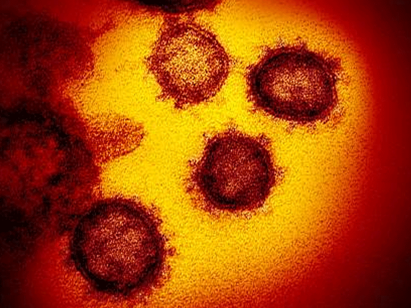 24 tested positive to coronavirus: NIH