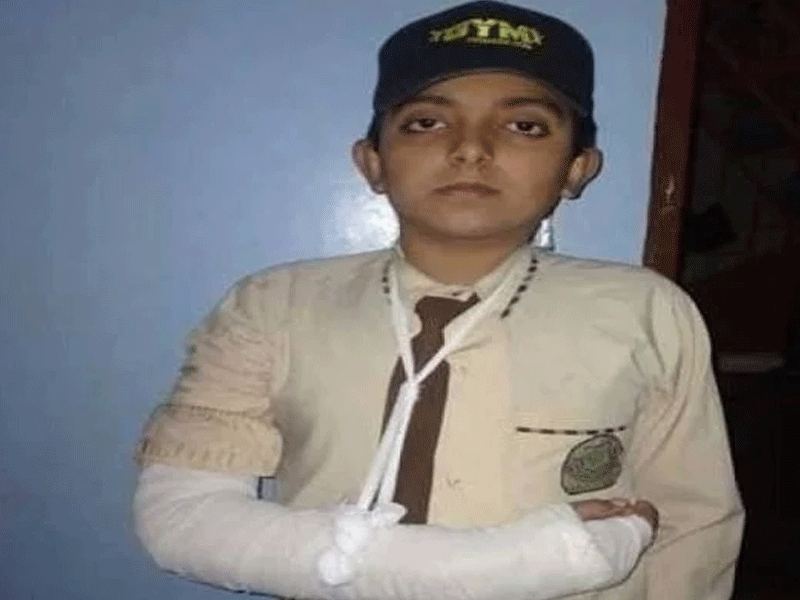 Student’s hand fractured after being tortured at school